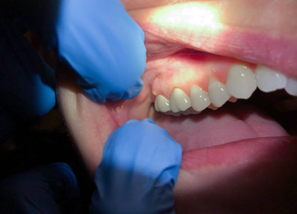 Best Emergency Dental Services for Seniors in New Windsor, MD